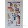 The Latest 3d Medical Education Poster Breast Cancer Propaganda Poster